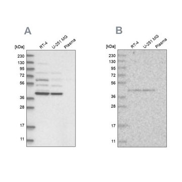 Anti-GPN1 antibody produced in rabbit Prestige Antibodies&#174; Powered by Atlas Antibodies, affinity isolated antibody, buffered aqueous glycerol solution