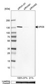 Anti-XPO5 antibody produced in rabbit Prestige Antibodies® Powered by Atlas Antibodies, affinity isolated antibody, buffered aqueous glycerol solution