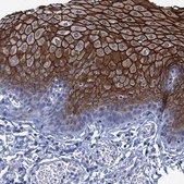 Anti-SCEL antibody produced in rabbit Prestige Antibodies® Powered by Atlas Antibodies, affinity isolated antibody, buffered aqueous glycerol solution