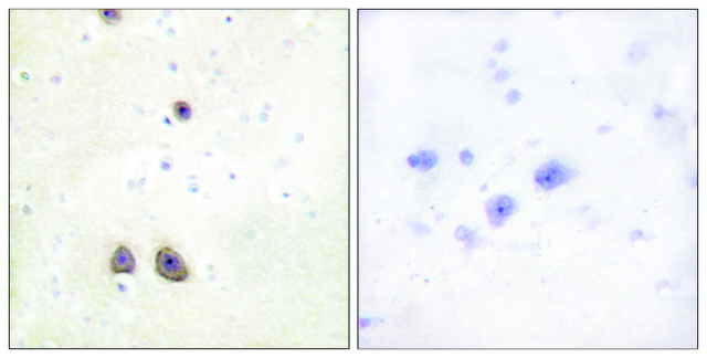 Anti-Caper antibody produced in rabbit affinity isolated antibody