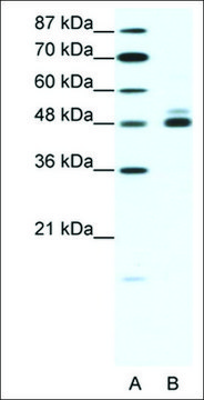 Anti-CHRNB2 antibody produced in rabbit affinity isolated antibody