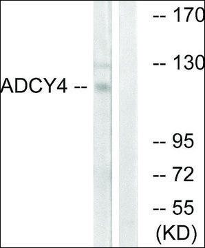 Anti-ADCY4 antibody produced in rabbit affinity isolated antibody