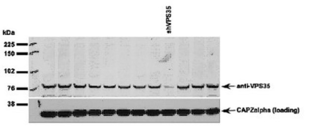 Anti-Vesicle protein sorting 35 (VPS35) Antibody from rabbit