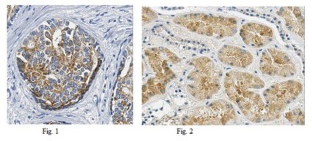 Anti-AMACR Antibody, clone 2A10F3 ascites fluid, clone 2A10F3, from mouse