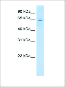 Anti-CYP2E1 affinity isolated antibody