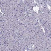 Anti-CREB3L3 antibody produced in rabbit Prestige Antibodies® Powered by Atlas Antibodies, affinity isolated antibody, buffered aqueous glycerol solution