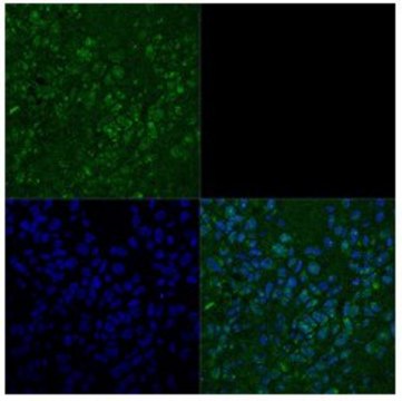 Anti-TBX3 antibody produced in rabbit affinity isolated antibody