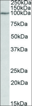 Anti-DAB2 antibody produced in goat affinity isolated antibody, buffered aqueous solution