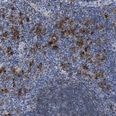 Anti-HLA-DPA1 antibody produced in rabbit Prestige Antibodies® Powered by Atlas Antibodies, affinity isolated antibody, buffered aqueous glycerol solution