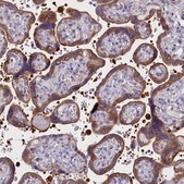 Anti-PPP1R13L antibody produced in rabbit Prestige Antibodies® Powered by Atlas Antibodies, affinity isolated antibody, buffered aqueous glycerol solution