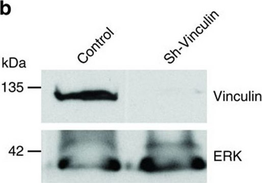 黏着斑蛋白单克隆抗体 小鼠抗 clone VIN-11-5, ascites fluid