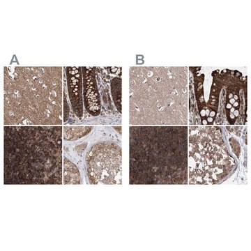 Anti-VPS37B antibody produced in rabbit Prestige Antibodies&#174; Powered by Atlas Antibodies, affinity isolated antibody, buffered aqueous glycerol solution