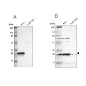 Anti-HPGD antibody produced in rabbit Prestige Antibodies® Powered by Atlas Antibodies, affinity isolated antibody, buffered aqueous glycerol solution