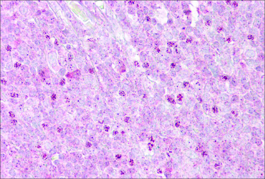 Anti-OAS1 antibody produced in rabbit affinity isolated antibody