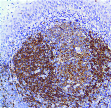 Anti-CD22 antibody, Rabbit monoclonal recombinant, expressed in proprietary host, clone SP104, affinity isolated antibody