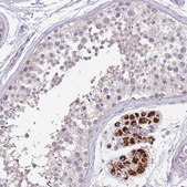 Anti-ZNF746 antibody produced in rabbit Prestige Antibodies® Powered by Atlas Antibodies, affinity isolated antibody, buffered aqueous glycerol solution