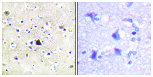 Anti-GR antibody produced in rabbit affinity isolated antibody