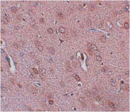 Anti-TRESK Antibody from rabbit, purified by affinity chromatography