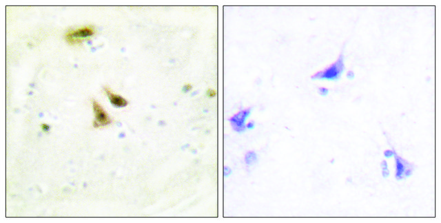 Anti-UBF1 antibody produced in rabbit affinity isolated antibody