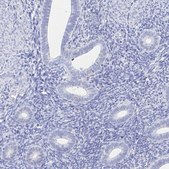 Anti-HSPA4L antibody produced in rabbit Prestige Antibodies® Powered by Atlas Antibodies, affinity isolated antibody, buffered aqueous glycerol solution
