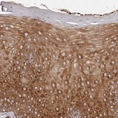 Anti-RPS6 antibody produced in rabbit Prestige Antibodies® Powered by Atlas Antibodies, affinity isolated antibody, buffered aqueous glycerol solution