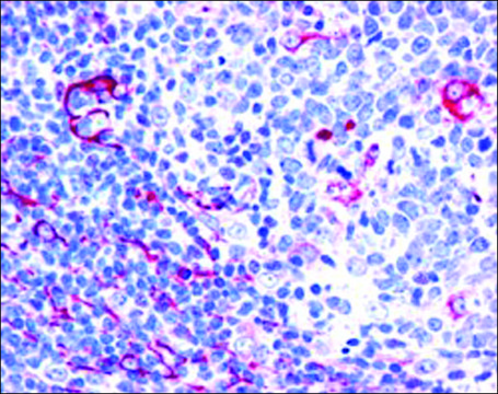 Anti-NET1/ARHGEF8, C-Terminal antibody produced in goat affinity isolated antibody, buffered aqueous solution