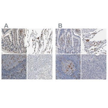 Anti-SKAP2 antibody produced in rabbit Prestige Antibodies&#174; Powered by Atlas Antibodies, affinity isolated antibody, buffered aqueous glycerol solution