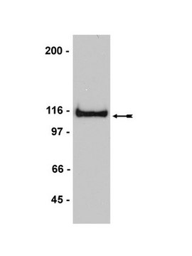 Anti-APP Antibody Upstate&#174;, from rabbit