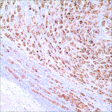 BCA-225 (Cu-18) Mouse Monoclonal Antibody