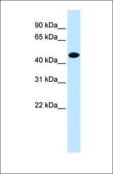 Anti-CKM (ab1) antibody produced in rabbit affinity isolated antibody