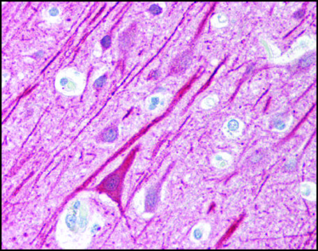 Anti-VISA (AB1) antibody produced in rabbit affinity isolated antibody, buffered aqueous solution