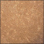 Rat Skeletal Muscle Cells: RSkMC, neonatal