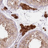 Anti-PROKR2 antibody produced in rabbit Prestige Antibodies® Powered by Atlas Antibodies, affinity isolated antibody, buffered aqueous glycerol solution