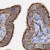 Anti-CEP68 antibody produced in rabbit Prestige Antibodies® Powered by Atlas Antibodies, affinity isolated antibody, buffered aqueous glycerol solution