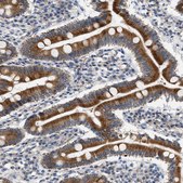 Anti-HSD17B11 antibody produced in rabbit Prestige Antibodies® Powered by Atlas Antibodies, affinity isolated antibody, buffered aqueous glycerol solution