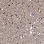 Anti-PRDX4 antibody produced in rabbit Prestige Antibodies® Powered by Atlas Antibodies, affinity isolated antibody, buffered aqueous glycerol solution
