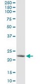 Monoclonal Anti-YKT6, (C-terminal) antibody produced in mouse clone 1F8, purified immunoglobulin, buffered aqueous solution