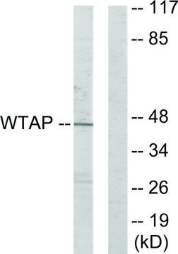 Anti-WTAP antibody produced in rabbit affinity isolated antibody