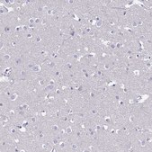 Anti-FAM160A1 antibody produced in rabbit Prestige Antibodies® Powered by Atlas Antibodies, affinity isolated antibody, buffered aqueous glycerol solution