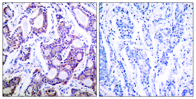 Anti-NF-&#954;B p100 antibody produced in rabbit affinity isolated antibody