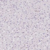 Anti-STK39 antibody produced in rabbit Prestige Antibodies® Powered by Atlas Antibodies, affinity isolated antibody, buffered aqueous glycerol solution