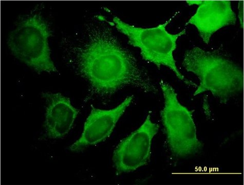 Monoclonal Anti-ALDOA antibody produced in mouse clone 3D9-6F3, purified immunoglobulin, buffered aqueous solution