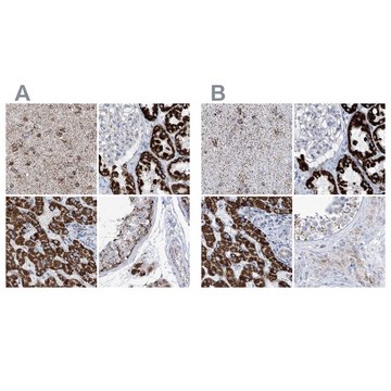 Anti-ALDH6A1 antibody produced in rabbit Prestige Antibodies&#174; Powered by Atlas Antibodies, affinity isolated antibody, buffered aqueous glycerol solution, ab1