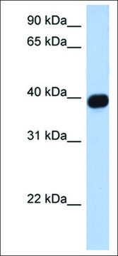 Anti-CXCR6 antibody produced in rabbit affinity isolated antibody