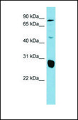 Anti-SLC26A4 antibody produced in rabbit affinity isolated antibody