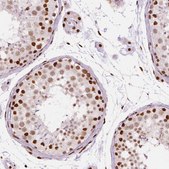 Monoclonal Anti-BRD4 antibody produced in mouse Prestige Antibodies® Powered by Atlas Antibodies, clone CL1118, purified immunoglobulin, buffered aqueous glycerol solution