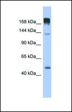 Anti-SLIT3, (N-terminal) antibody produced in rabbit affinity isolated antibody