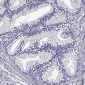 Anti-ADAM32 antibody produced in rabbit Prestige Antibodies® Powered by Atlas Antibodies, affinity isolated antibody, buffered aqueous glycerol solution