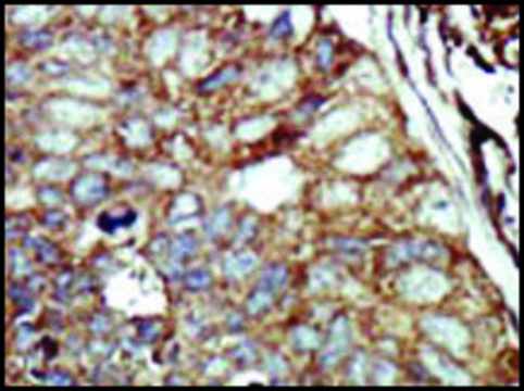 Anti-DGKQ (C-term) antibody produced in rabbit IgG fraction of antiserum, buffered aqueous solution