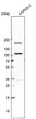 Anti-PIBF1 antibody produced in rabbit Prestige Antibodies® Powered by Atlas Antibodies, affinity isolated antibody